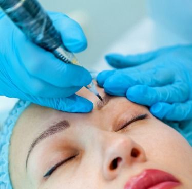 Eyebrow restructuring