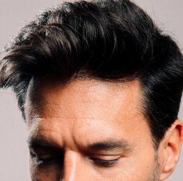 WHAT ARE THE POSSIBLE ANTI-BALDNESS TREATMENTS?