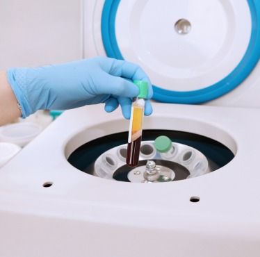 WHAT TREATMENTS ARE AVAILABLE?