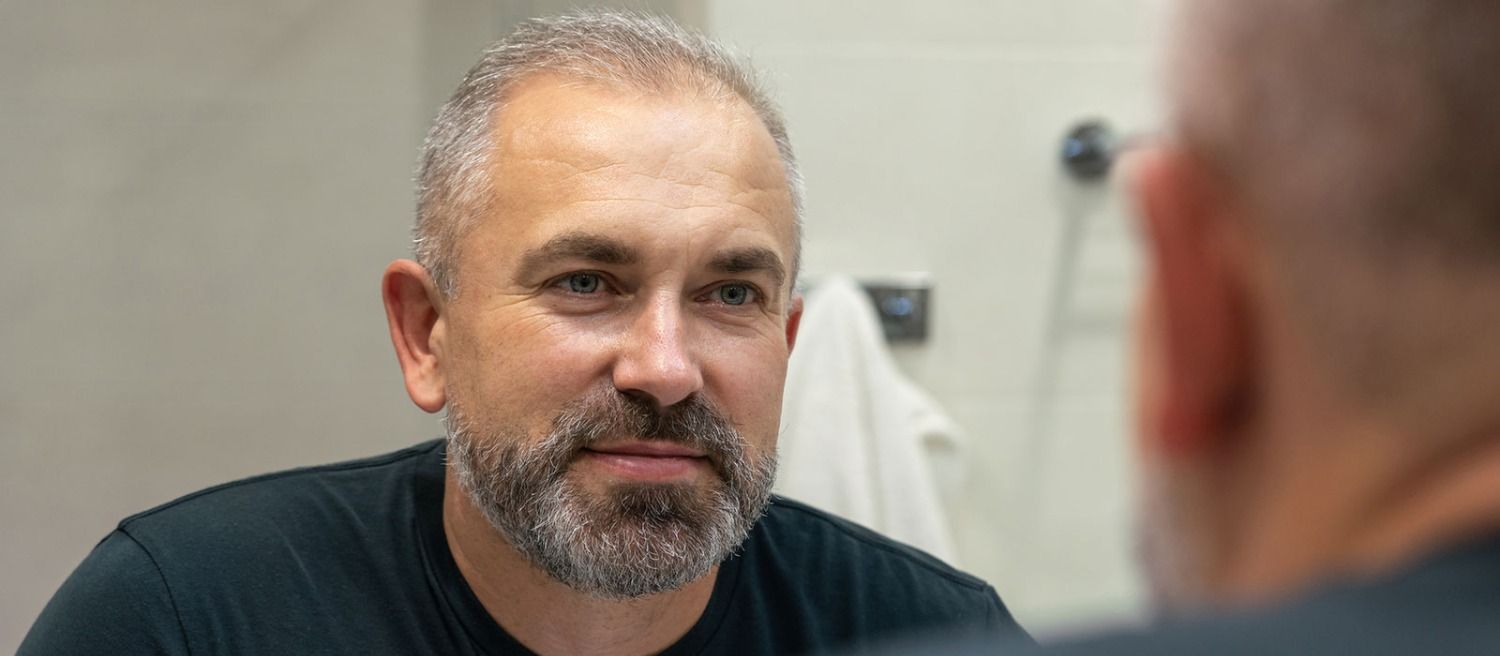 alopecie_androgenetique_quels_traitements_pour_freiner_la_chute_et_favoriser_la_repousse