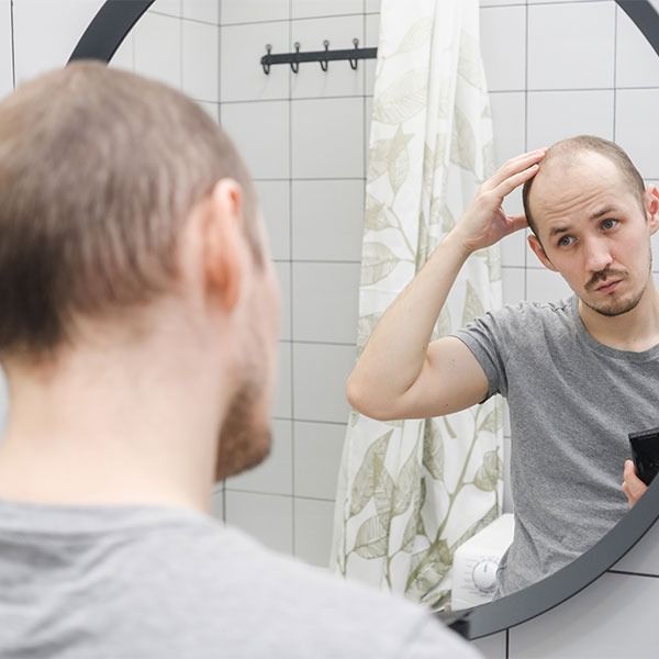 perte_de_cheveux_chez_lhomme_jeune_2030_ans_agir_tot_est_ce_vraiment_utile_