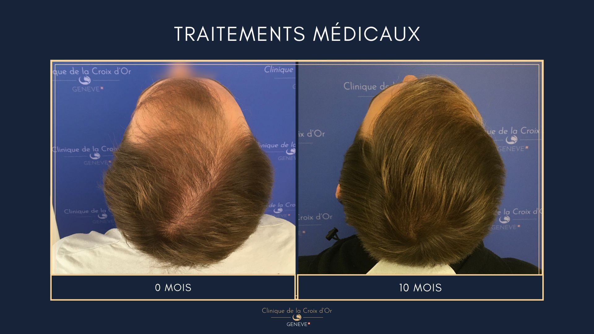 Medical treatments
